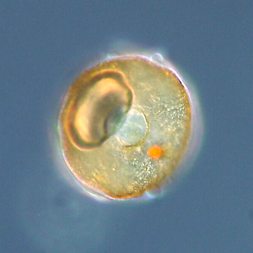 Actual differential-interference-contrast microscope image of a modern Arcella testate amoeba from a pond in Tsukuba, Japan; illustrative reference organism, not a fossil from the fictional peatland case.