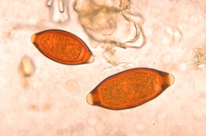 US CDC scientific comparison of Trichuris trichiura and Trichuris vulpis whipworm eggs, illustrating diagnostic microscopic differences. Modern clinical reference, not the fictional ancient latrine sample.