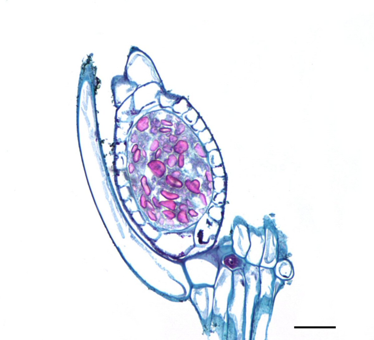 Genuine stained light micrograph of a Chara oogonium with spiral jacket cells and a 0.2 mm scale, representing a modern reproductive structure rather than a fossil oospore or a fictional lake-core specimen.