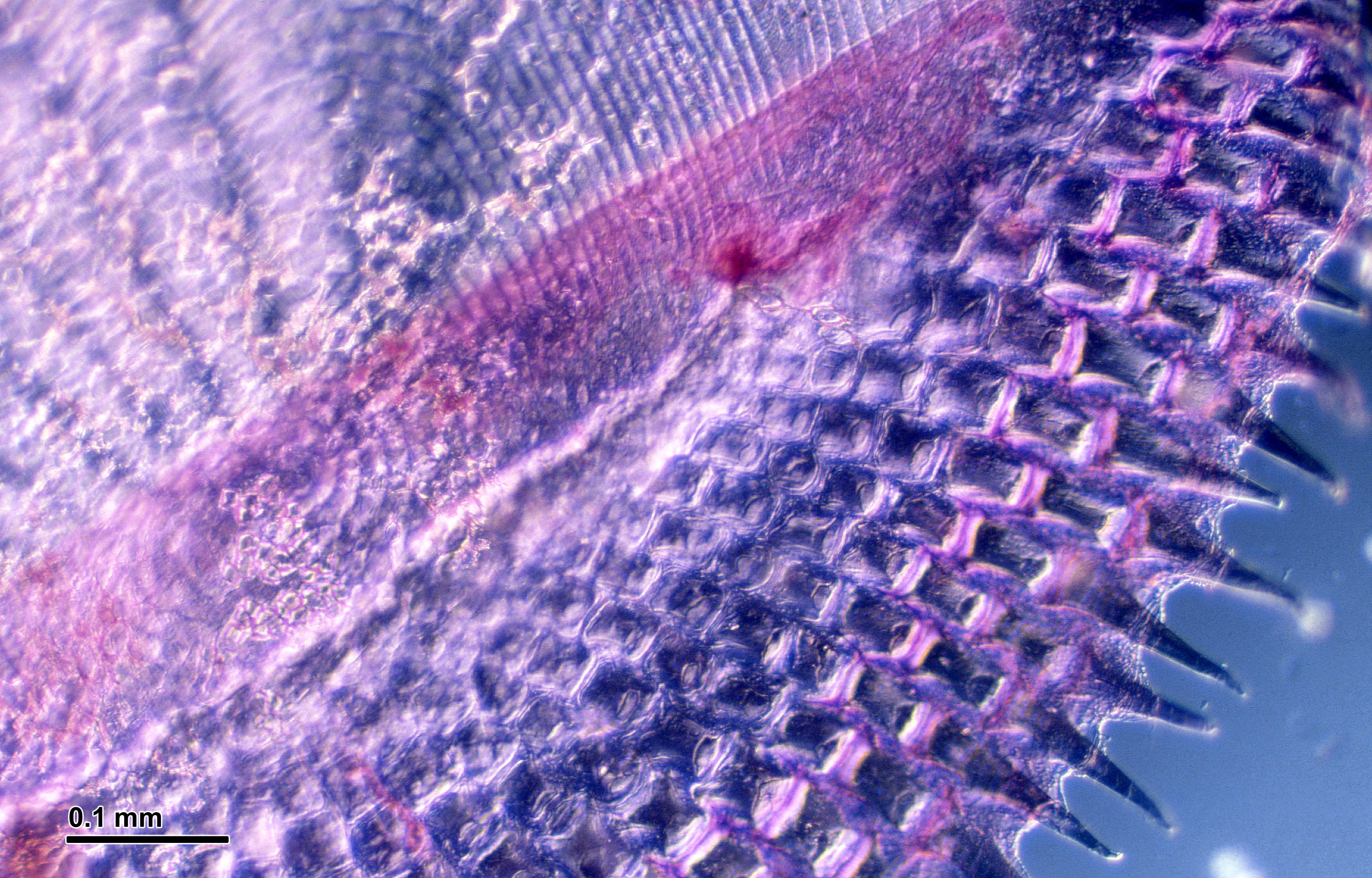 Real ctenoid fish scale under differential-interference-contrast light microscopy with comb-like tooth projections and stained surface; modern reference, not an archaeological fish scale from fictional Riverbend Lake.