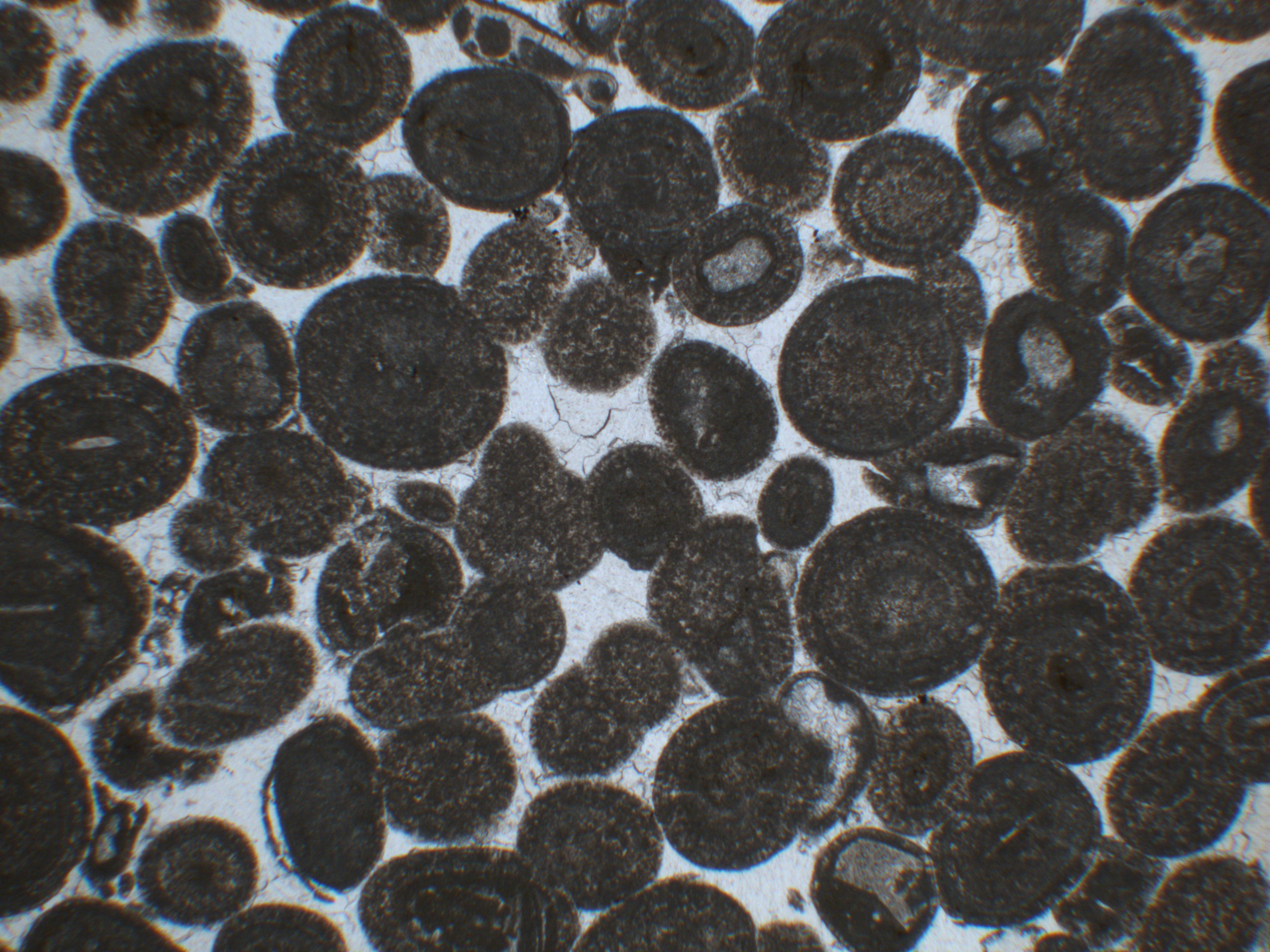Plane-polarized microscopic photograph of oolitic limestone gravel in a soil thin section from an Iron Age archaeological settlement in Switzerland, image width about 4.5 mm.