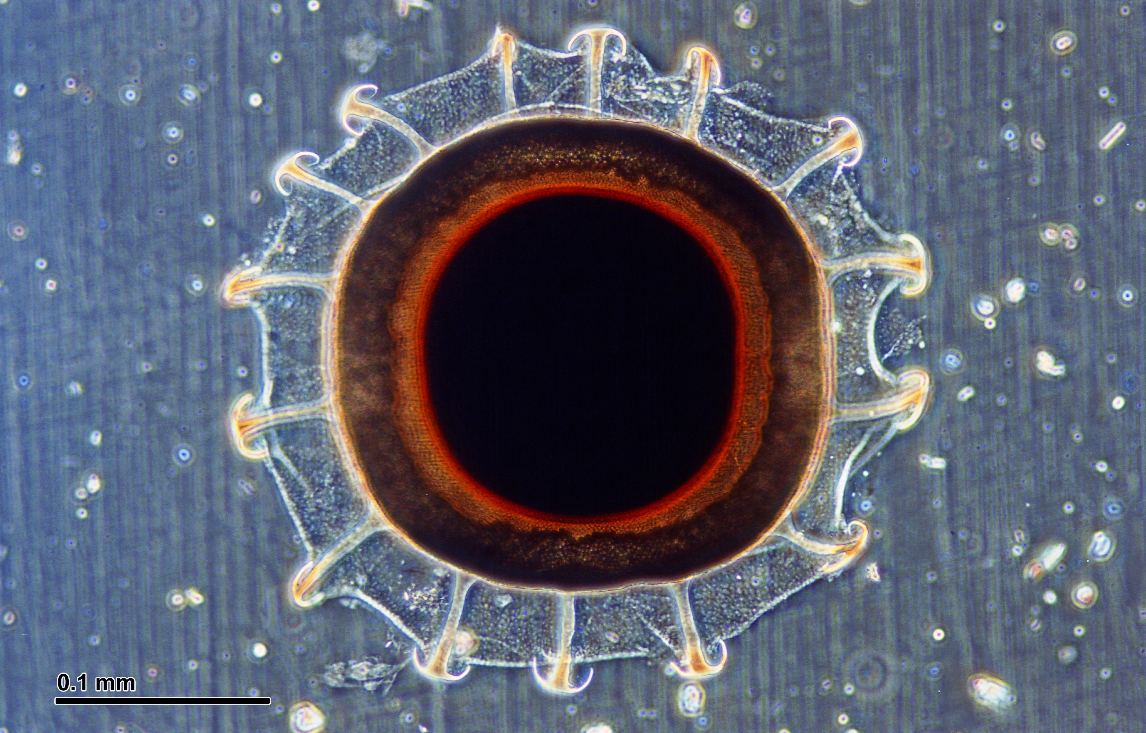 Authentic negative-phase-contrast light micrograph of a modern Pectinatella magnifica freshwater bryozoan statoblast with circular centre and hooked outer projections; not a fossil from fictional Longmere Lake.